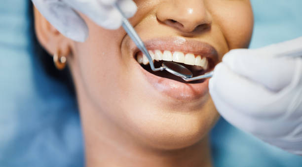 Best Orthodontic Emergency Dentist in Laguna Woods, CA